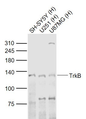 Anti-TrkB Polyclonal Antibody
