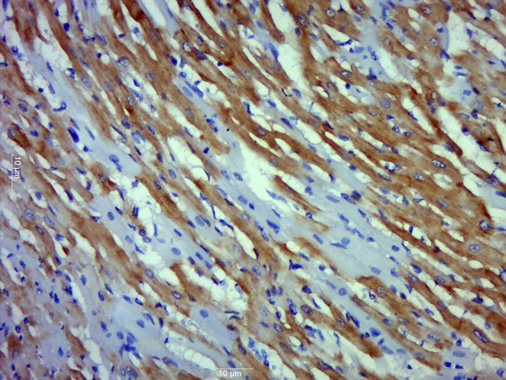 Anti-TNNI3 Polyclonal Antibody