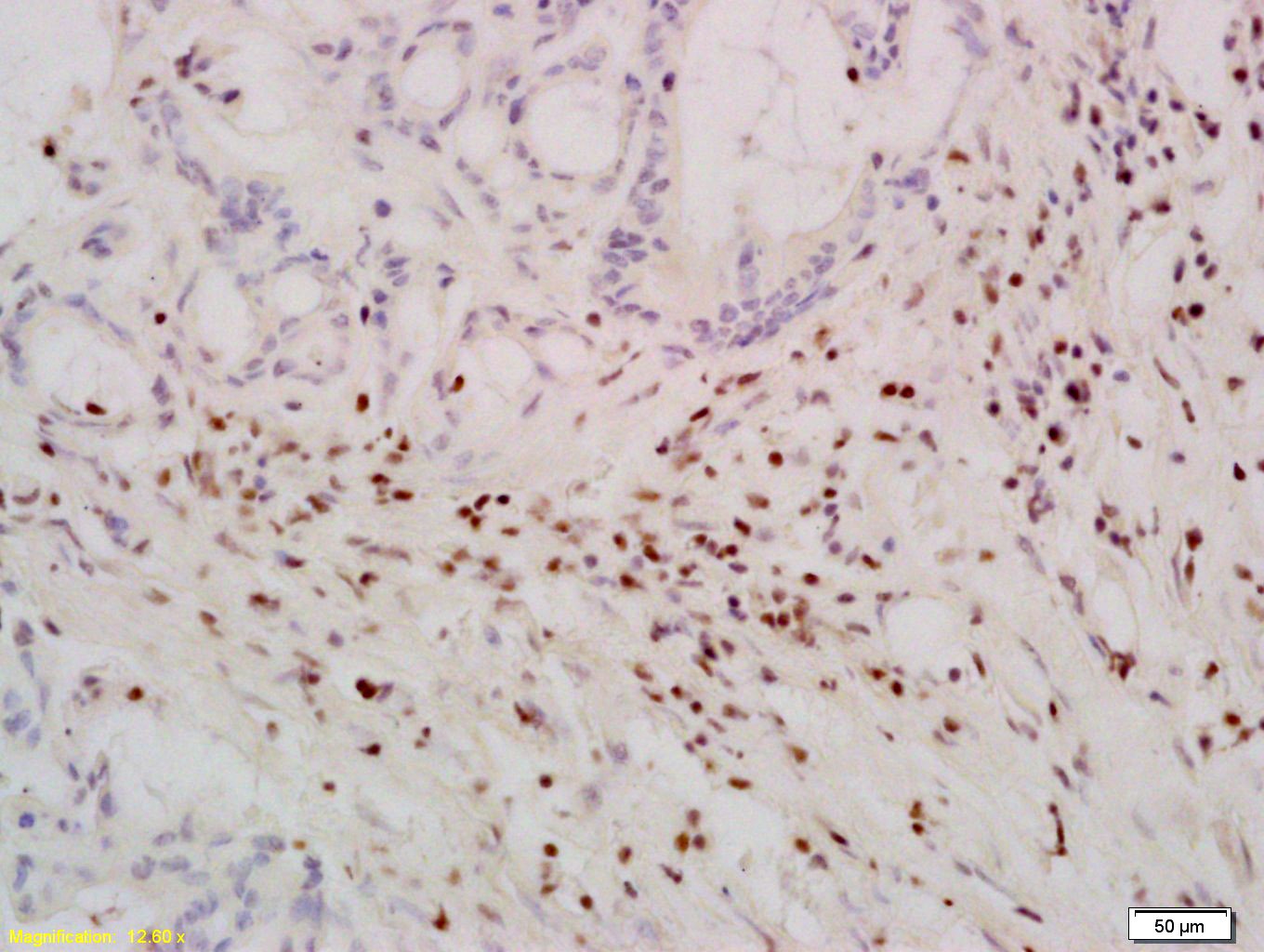 Anti-TERT Polyclonal Antibody