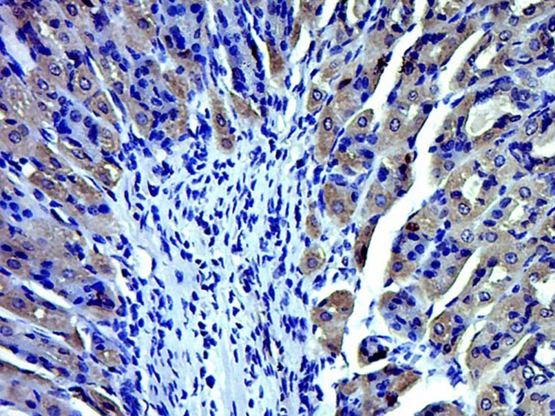 Anti-TRPV1 Polyclonal Antibody