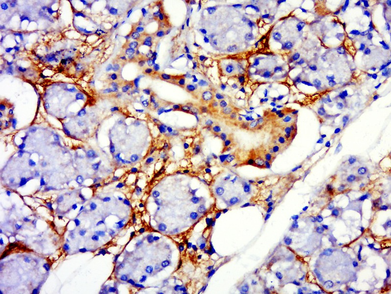 Anti-TSHR (CT) Polyclonal Antibody