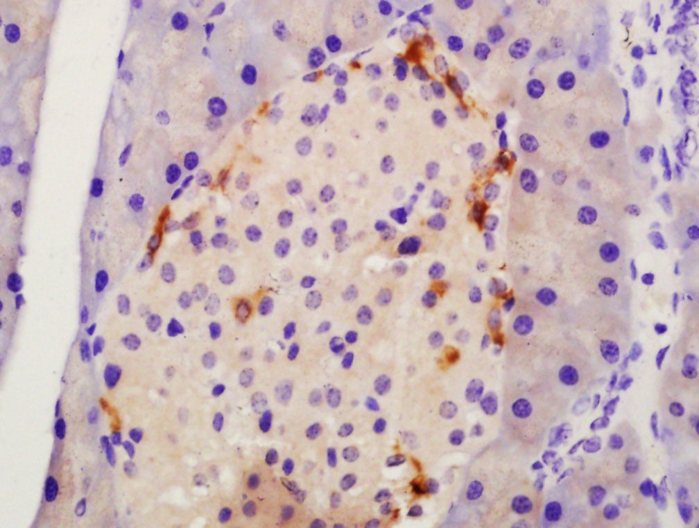Anti-TMEM49 Polyclonal Antibody