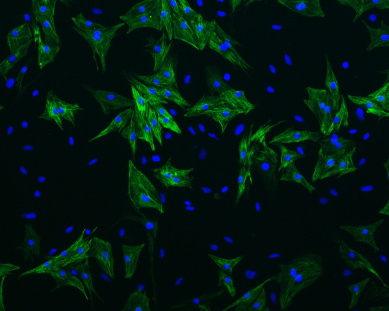Anti-TnTc Polyclonal Antibody