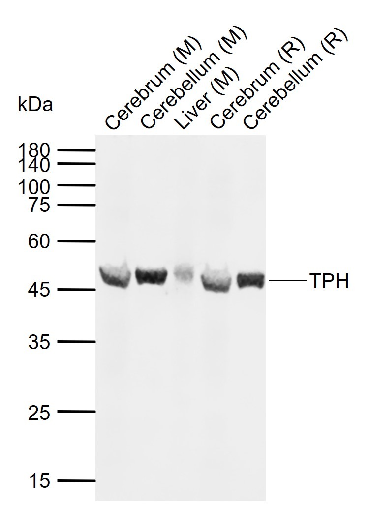 Anti-Tryptophan Hydroxylase 1/TPH-1 Polyclonal Antibody