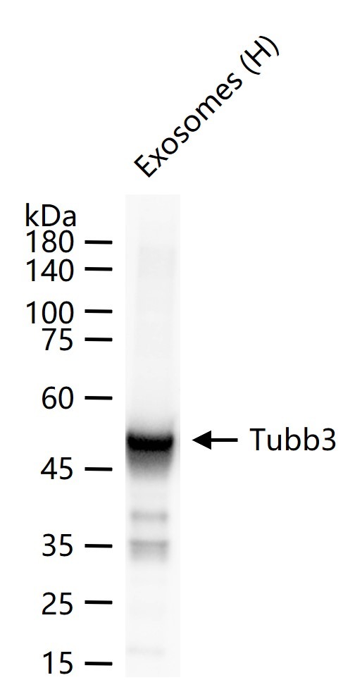 Anti-TUBB3 Antibody (1C239)