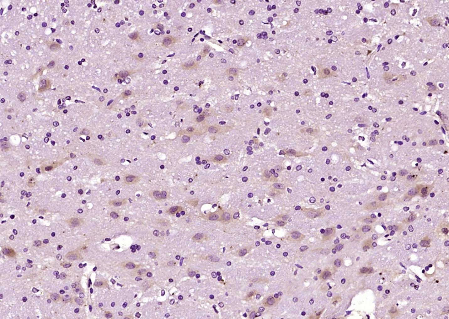 Anti-TPH2 Polyclonal Antibody