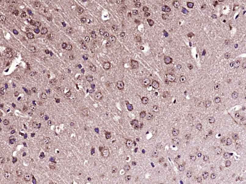 Anti-TUBB3 Polyclonal Antibody 2