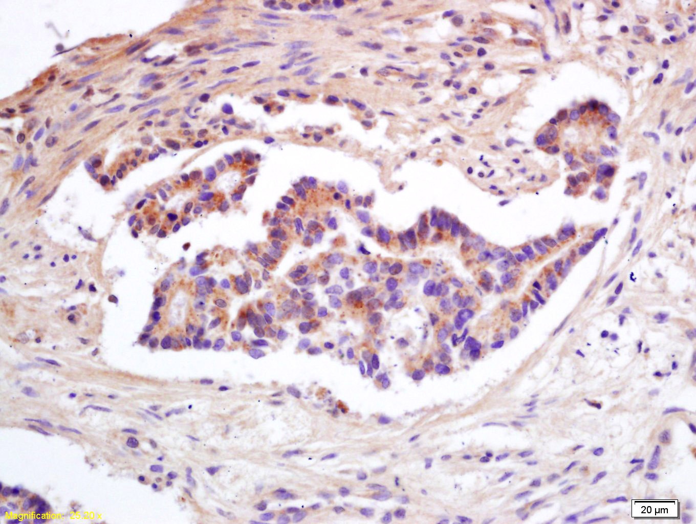 Anti-TIMP-1 Polyclonal Antibody 2