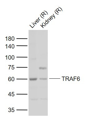 Anti-TRAF6 Polyclonal Antibody 2