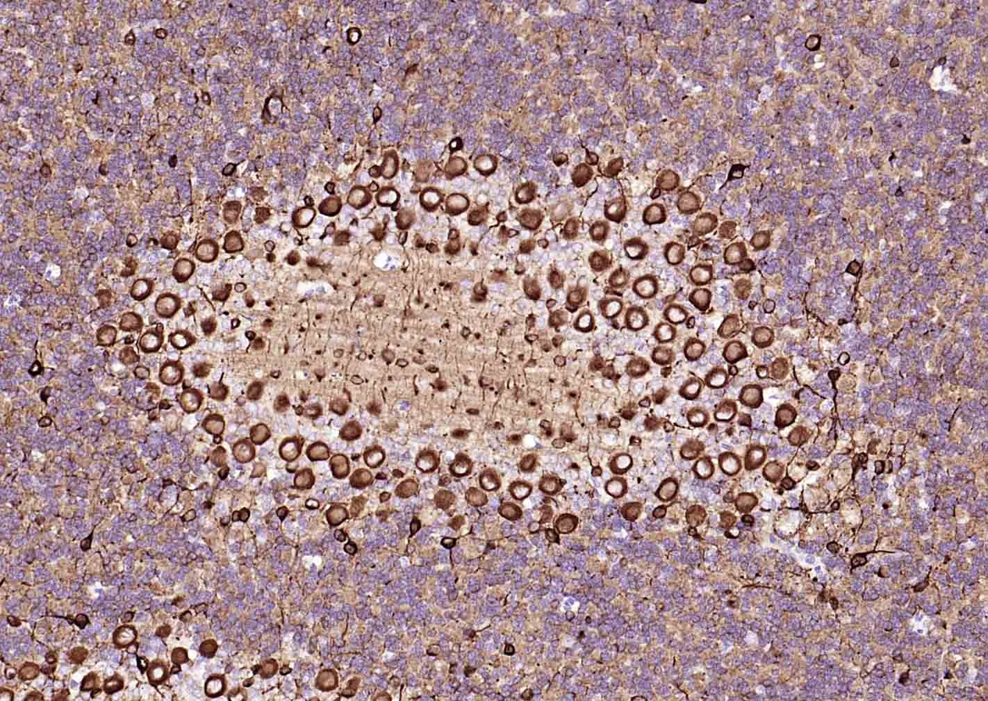 Anti-TUBB3 Antibody (1C239)