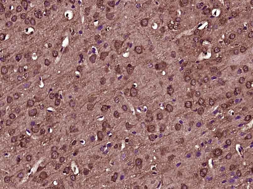 Anti-Tissue Factor Polyclonal Antibody