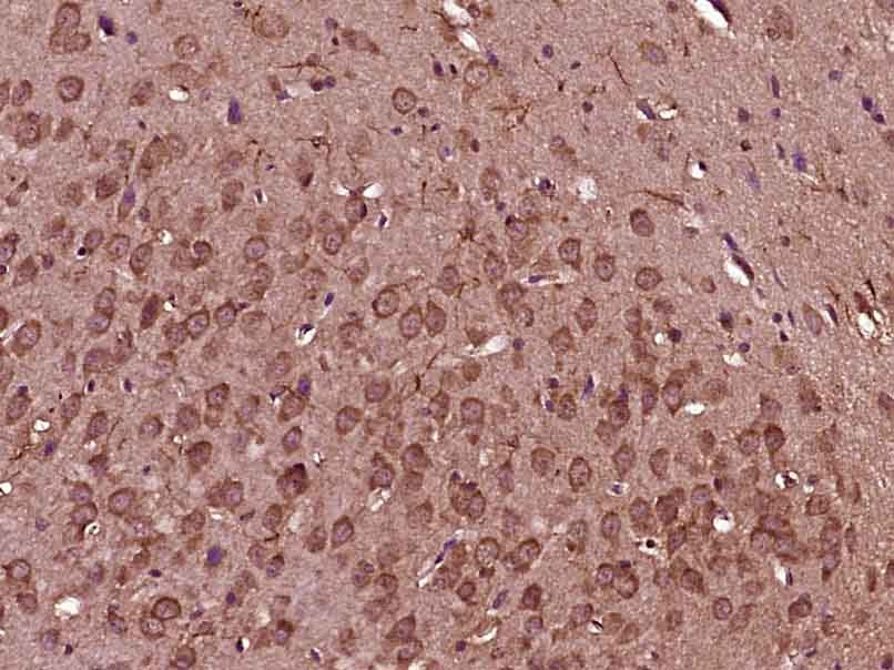 Anti-TIMP-1 Antibody (7V162)