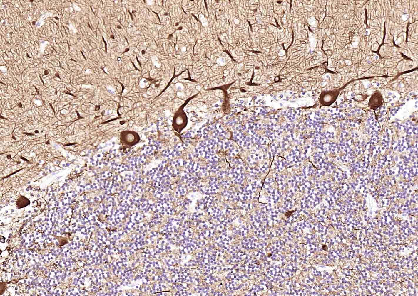 Anti-TUBB3 Antibody (1C239)