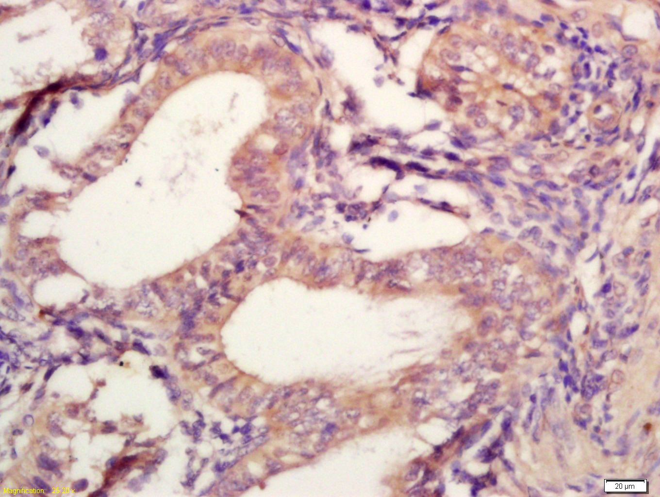 Anti-TIMP-2 Polyclonal Antibody