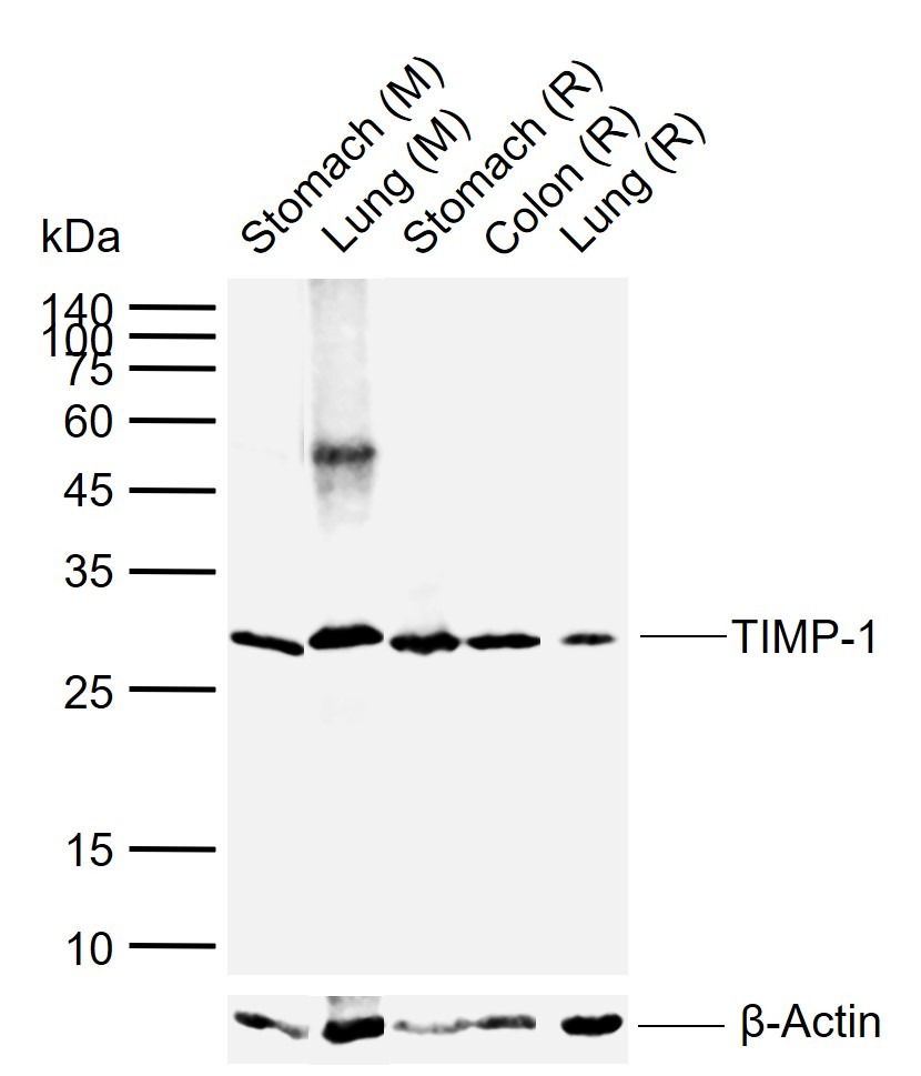 Anti-TIMP-1 Antibody (7V162)