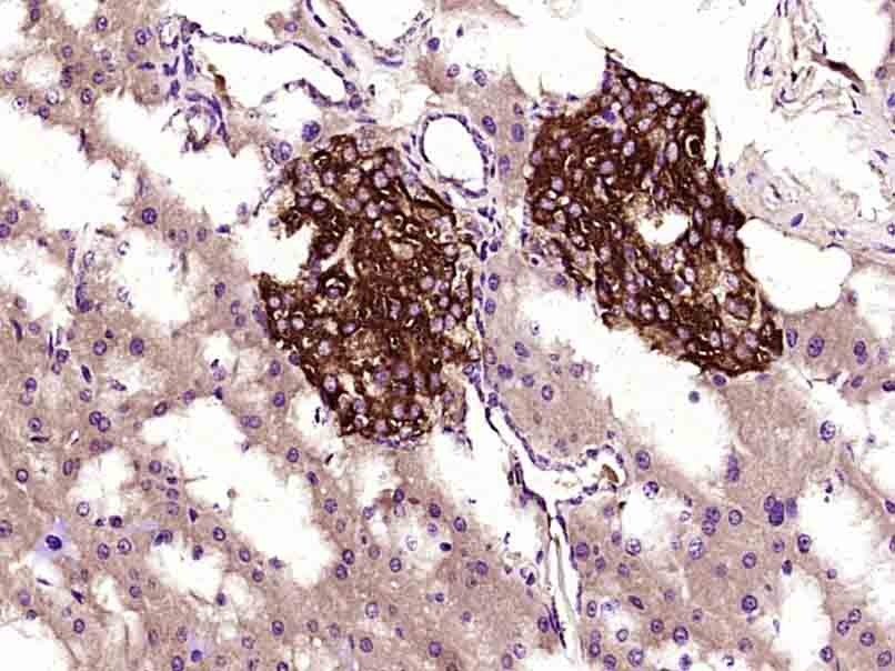 Anti-TIMP-1 Antibody (7V162)