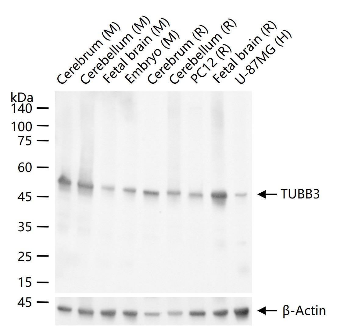Anti-TUBB3 Antibody (1C239)