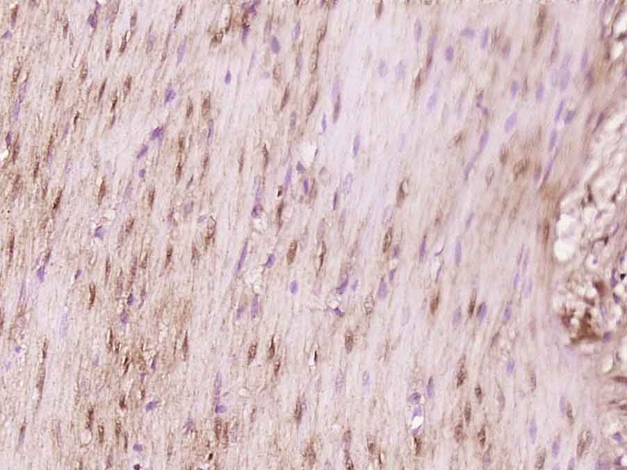 Anti-TPRX1 Polyclonal Antibody