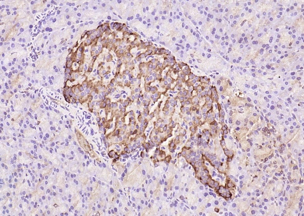 Anti-TIMP-1 Polyclonal Antibody 2