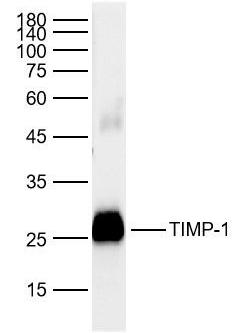 Anti-TIMP-1 Polyclonal Antibody