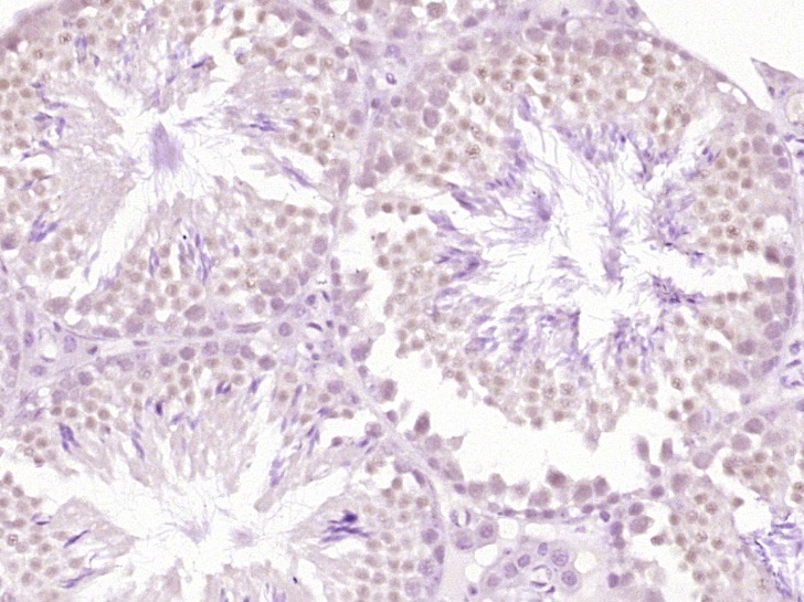 Anti-TKTL1 Polyclonal Antibody