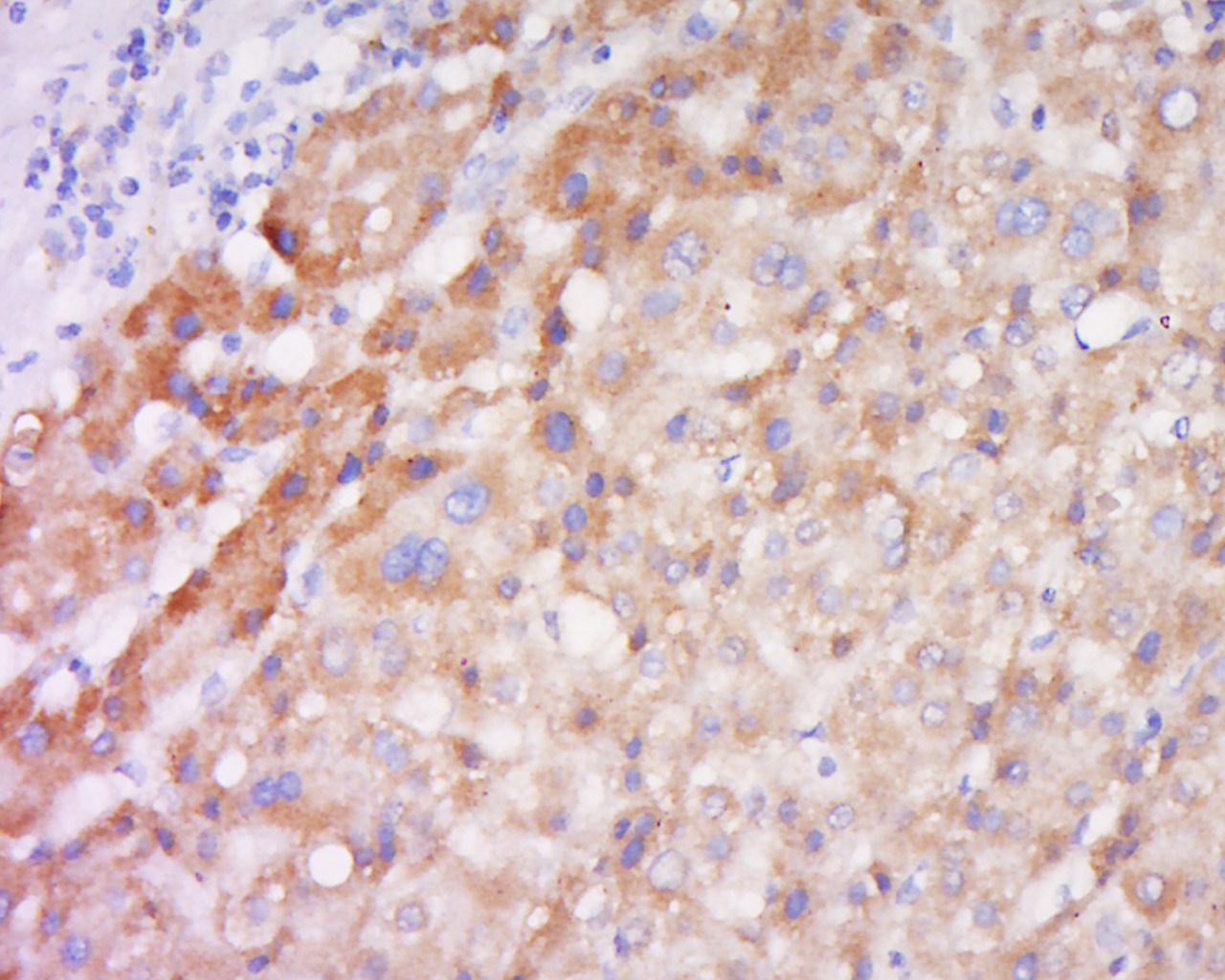 Anti-TSLP Polyclonal Antibody