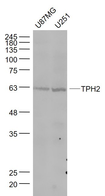 Anti-TPH2 Polyclonal Antibody