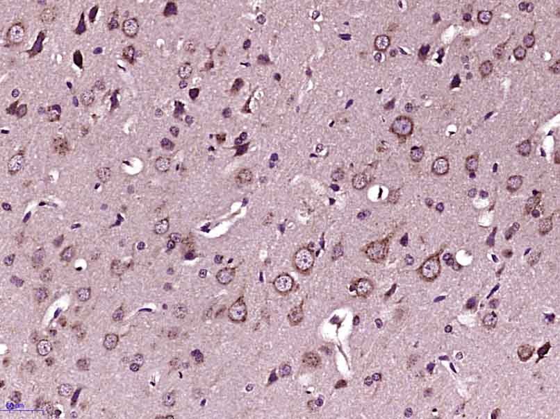 Anti-TUBB3 Polyclonal Antibody 2