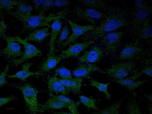 Anti-TLR4 Polyclonal Antibody