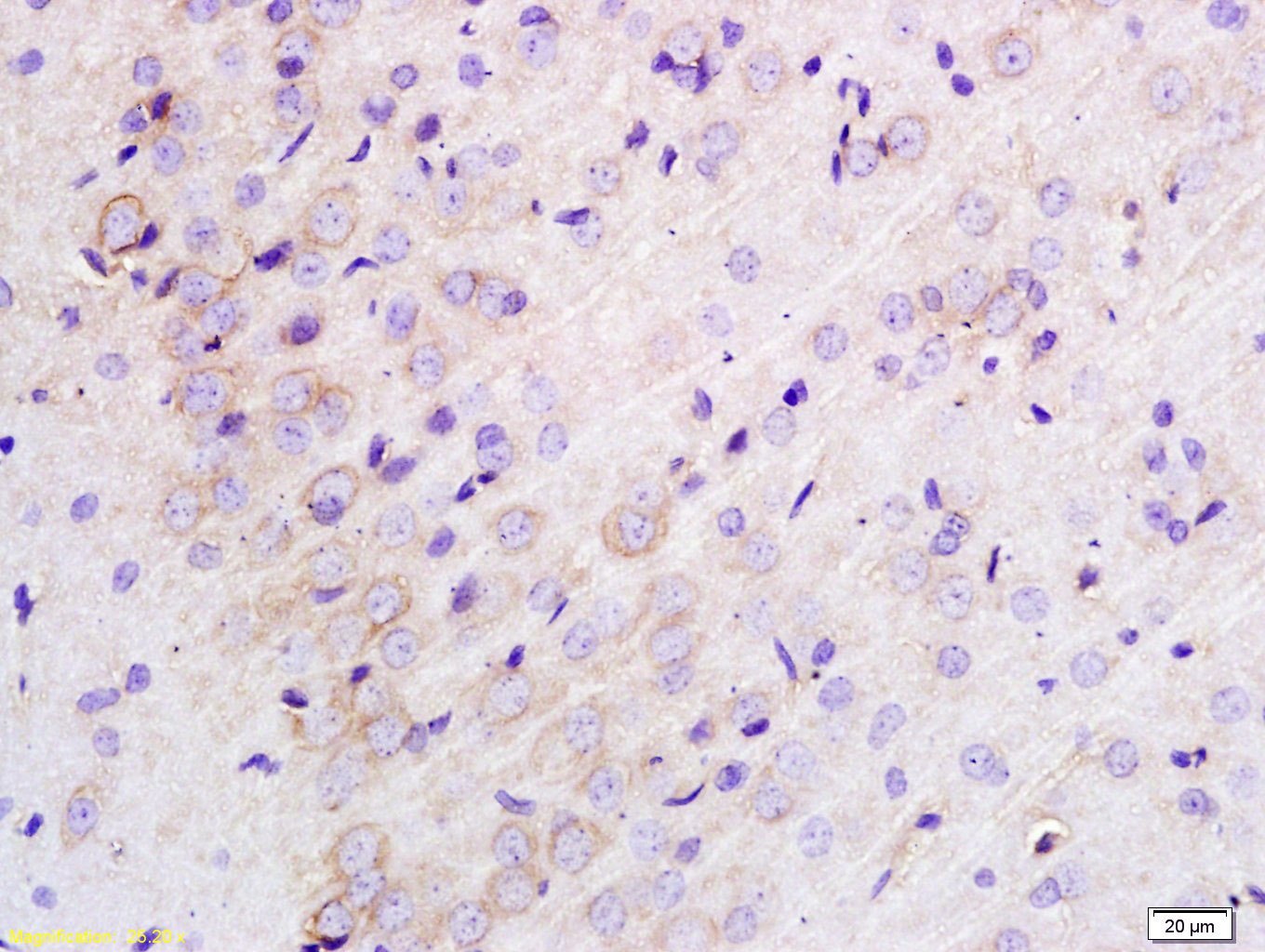 Anti-TLR1 Polyclonal Antibody