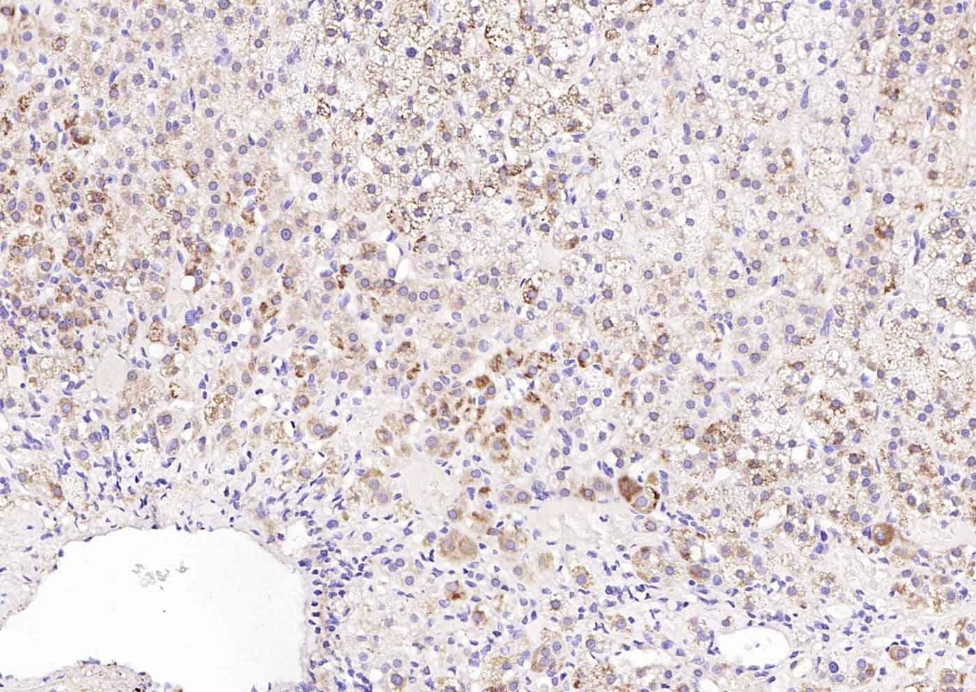 Anti-TM7SF2 Polyclonal Antibody