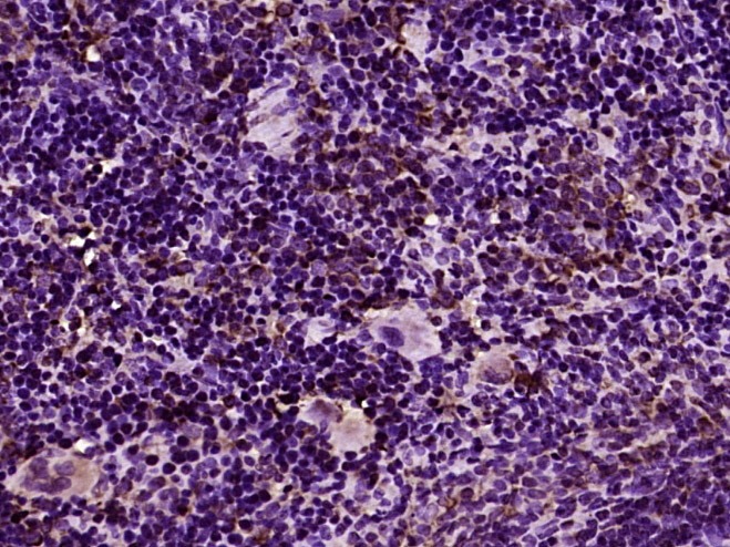 Anti-TLR8 Polyclonal Antibody