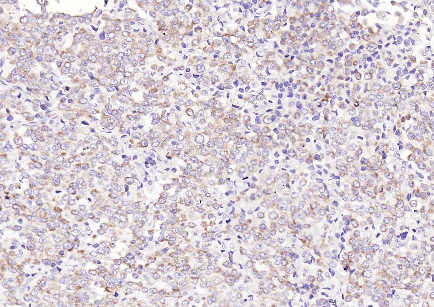 Anti-TM7SF2 Polyclonal Antibody