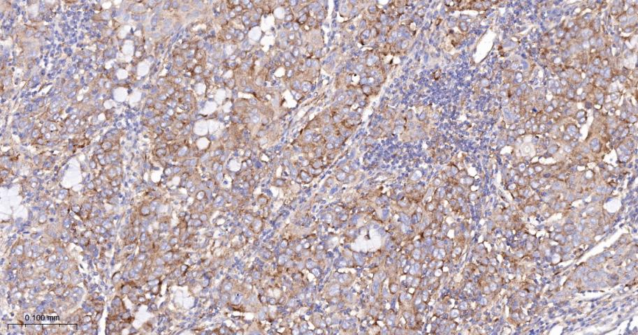 Anti-VEGFR1/FLT-1 Antibody (7V802)
