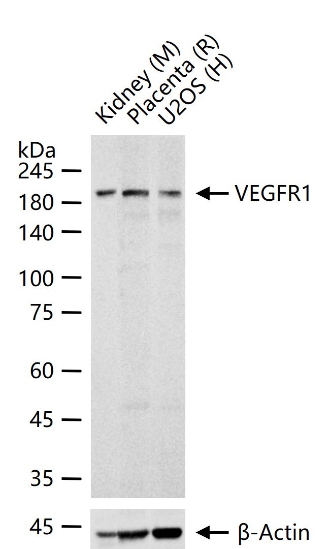 Anti-VEGFR1/FLT-1 Antibody (7V802)