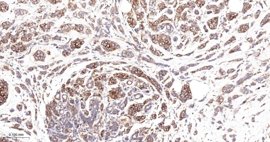 Anti-VEGFR1/FLT-1 Antibody (7V802)