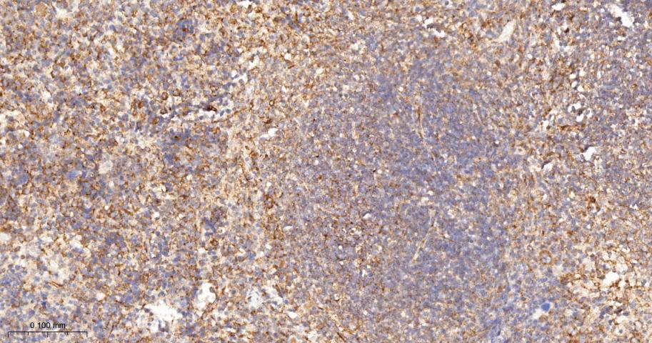 Anti-VEGFR1/FLT-1 Antibody (7V802)