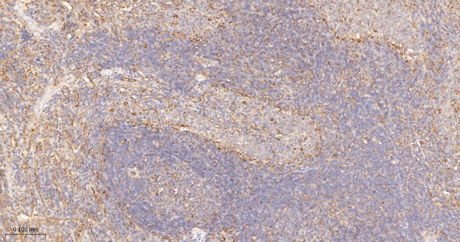Anti-VEGFR1/FLT-1 Antibody (7V802)