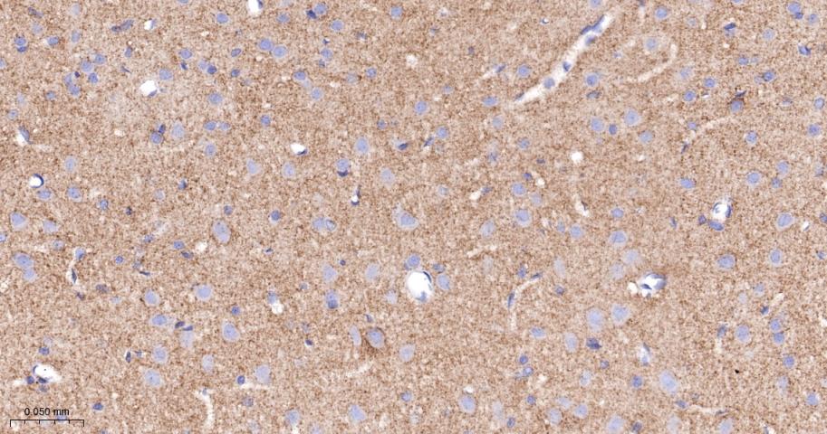 Anti-VEGFR1/FLT-1 Antibody (7V802)