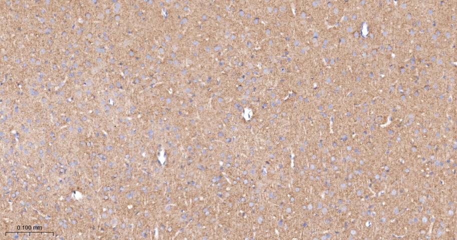 Anti-VEGFR1/FLT-1 Antibody (7V802)