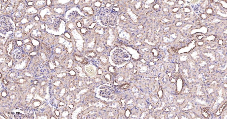 Anti-VEGFR1/FLT-1 Antibody (7V802)