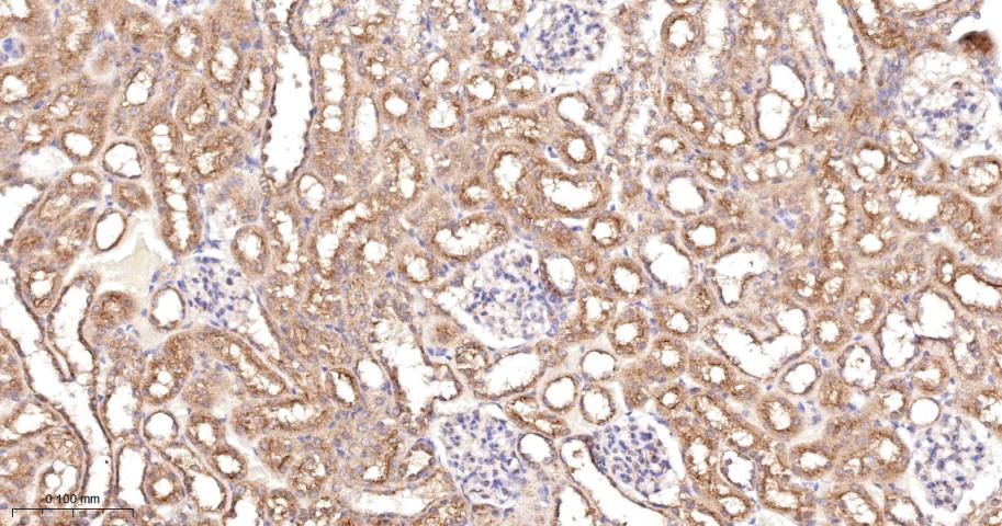 Anti-VEGFR1/FLT-1 Antibody (7V802)