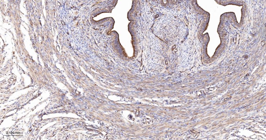 Anti-VEGFR1/FLT-1 Antibody (7V802)
