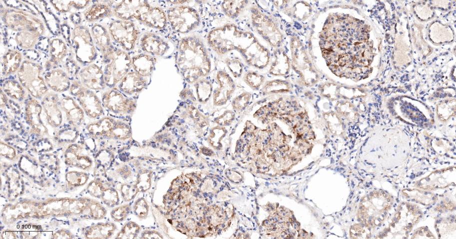 Anti-VEGFR1/FLT-1 Antibody (7V802)