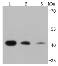 Anti-RPSA Antibody (6W769)