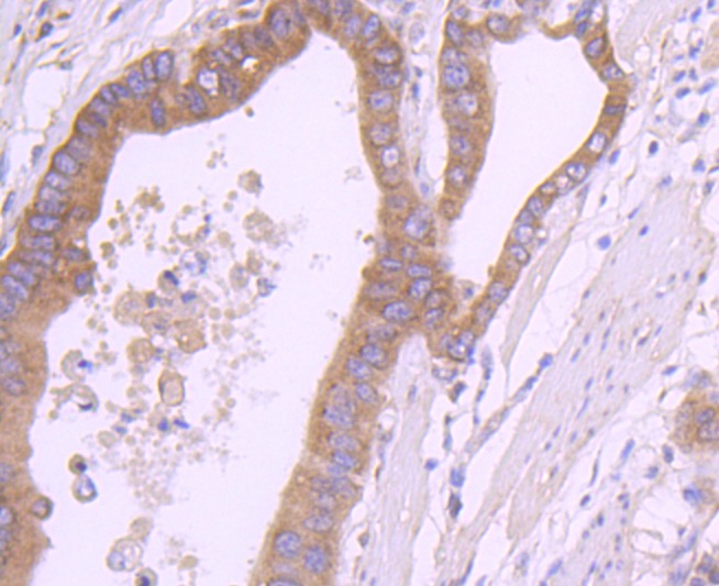 Anti-RPSA Antibody (6W769)