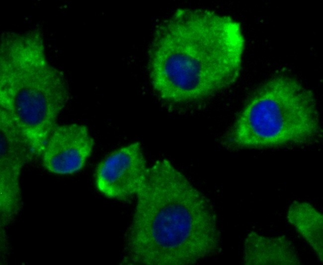 Anti-alpha Actinin 4 Antibody (7D211)