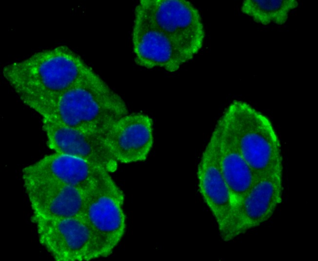 Anti-alpha Actinin 4 Antibody (7D211)