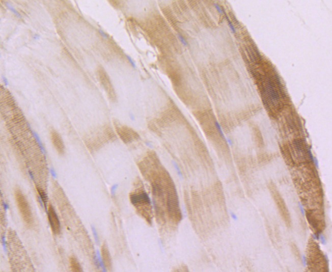 Anti-Alpha Actinin 2 Antibody (2O342)
