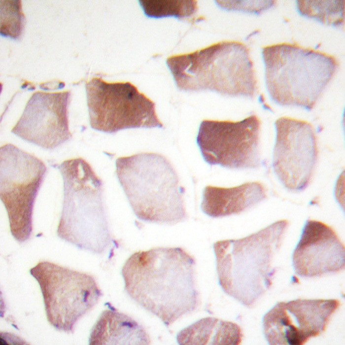 Anti-Phospho-ALOX5 (Ser272) Polyclonal Antibody